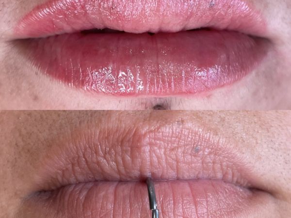 Lip blush before and after Vernon