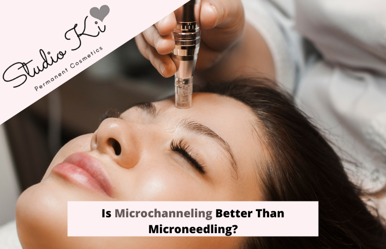 Is Microchanneling Better Than Microneedling?