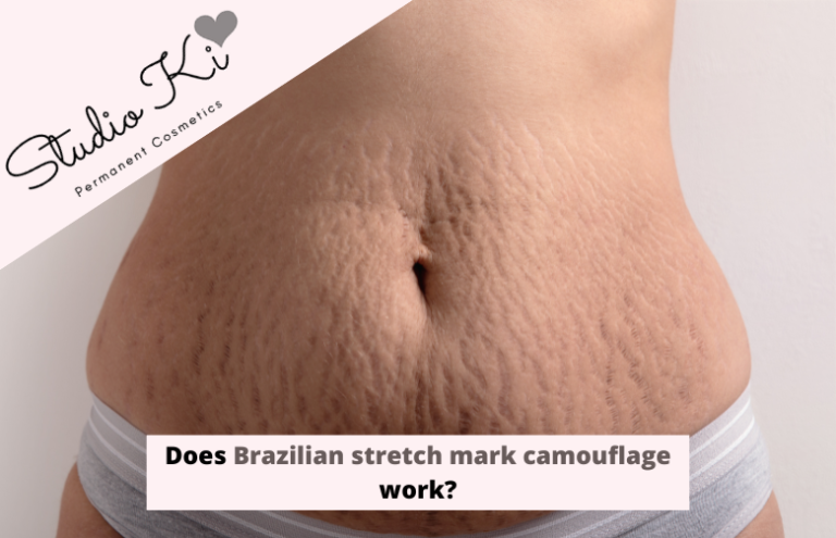 Does Brazilian Stretch Mark Camouflage Work?